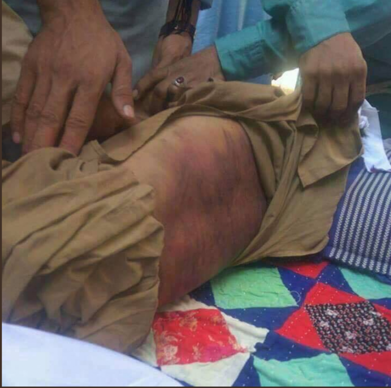 Pakistani boy dies after being beaten to death by his madrasa teacher in Karachi. His parents pardon the cleric.