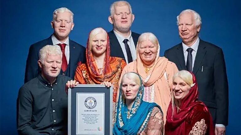 Asian and Albino: how a British family have set the new World Record for Most Albino Siblings in a Family