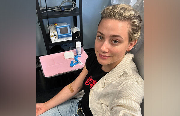 Lili Reinhart says “listen to your body” as her ‘mysterious’ chronic illness strikes